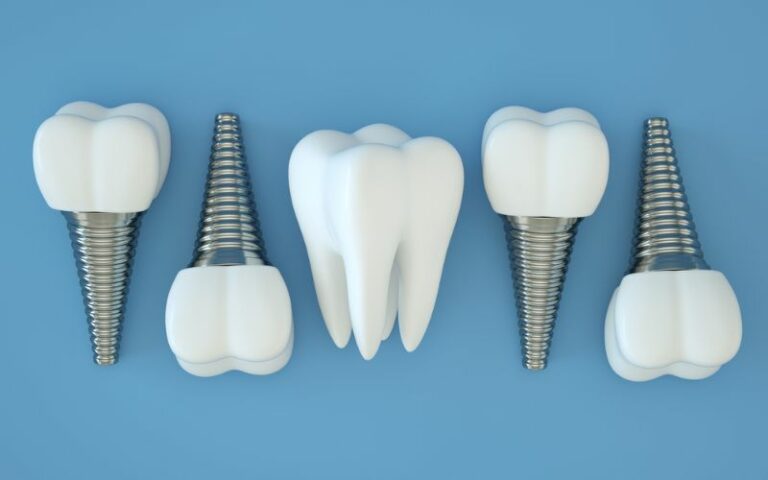 4 dental implants laying next to each other